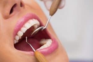 כל המידע על סוגי טיפולי שיניים